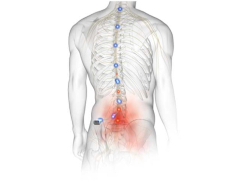 X-RAY like photo of spine